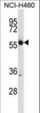 CRMP1 Antibody western blot of NCI-H460 cell line lysates (35 ug/lane). The CRMP1 antibody detected the CRMP1 protein (arrow).