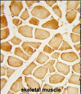 Formalin-fixed and paraffin-embedded human skeletal muscle reacted with CRNN Antibody (Center), which was peroxidase-conjugated to the secondary antibody, followed by DAB staining.