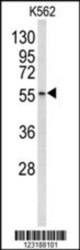 Western blot of CRNN Antibody (Center) in K562 cell line lysates (35 ug/lane). CRNN (arrow) was detected using the purified Pab.