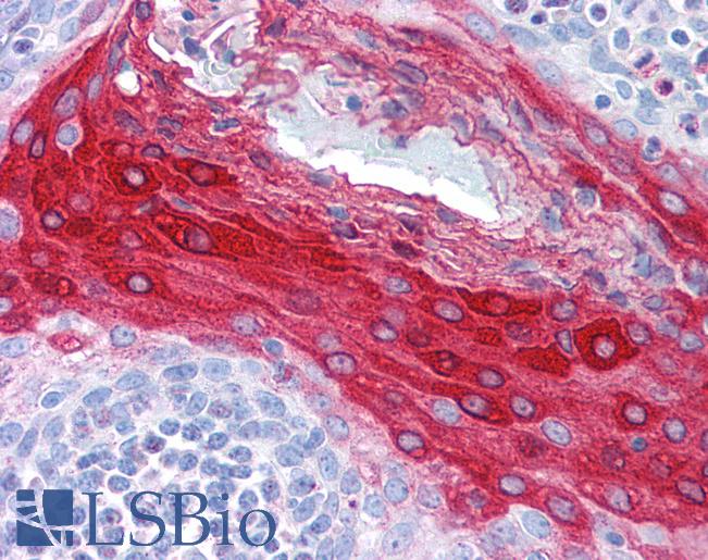 Anti-CRNN / Cornulin antibody IHC of human tonsil. Immunohistochemistry of formalin-fixed, paraffin-embedded tissue after heat-induced antigen retrieval. Antibody LS-B626 concentration 5 ug/ml.