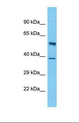 Western blot of Human Pancreas Tumor. LUC7L3 antibody dilution 1.0 ug/ml.