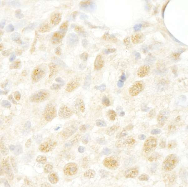 Detection of Mouse CROP/Luc7A by Immunohistochemistry. Sample: FFPE section of mouse colon carcinoma CT26. Antibody: Affinity purified rabbit anti-CROP/Luc7A used at a dilution of 1:250.