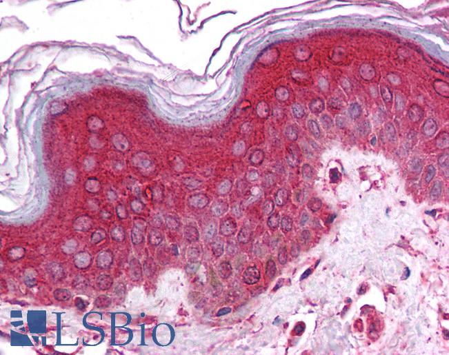 Anti-CHRNA9 antibody IHC of human skin. Immunohistochemistry of formalin-fixed, paraffin-embedded tissue after heat-induced antigen retrieval. Antibody LS-B936 concentration 5 ug/ml.