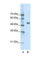 CHRNA9 antibody LS-B936 Western blot of Jurkat Cell lysate. Antibody concentration 1 ug/ml.