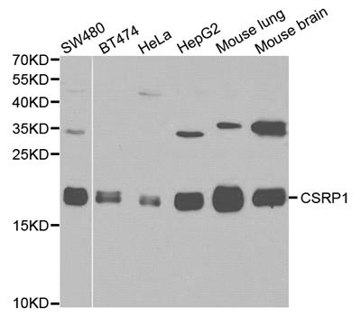Western blot analysis of various cell lines, using CSRP1 antibody.