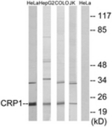 Western blot of extracts from HeLa/HepG2/COLO/Jurkat cells, using CRP1 Antibody. The lane on the right is treated with the synthesized peptide.