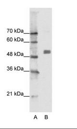 A: Marker, B: Jurkat Cell Lysate