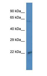 CRTAM antibody Western Blot of ACHN. Antibody dilution: 1 ug/ml.