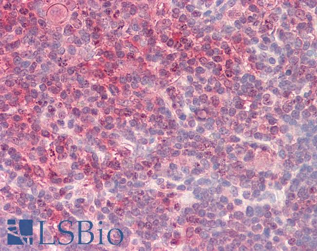 Anti-CRTC2 / TORC2 antibody IHC staining of human thymus. Immunohistochemistry of formalin-fixed, paraffin-embedded tissue after heat-induced antigen retrieval.