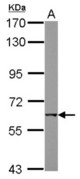 Sample (30 ug of whole cell lysate) A: MCF-7 7.5% SDS PAGE CHRNB1 antibody diluted at 1:1000