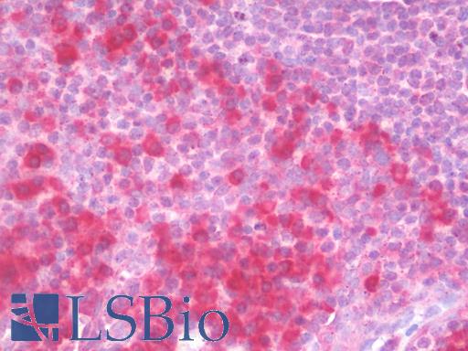 Anti-CRTC2 / TORC2 antibody IHC staining of human tonsil. Immunohistochemistry of formalin-fixed, paraffin-embedded tissue after heat-induced antigen retrieval.