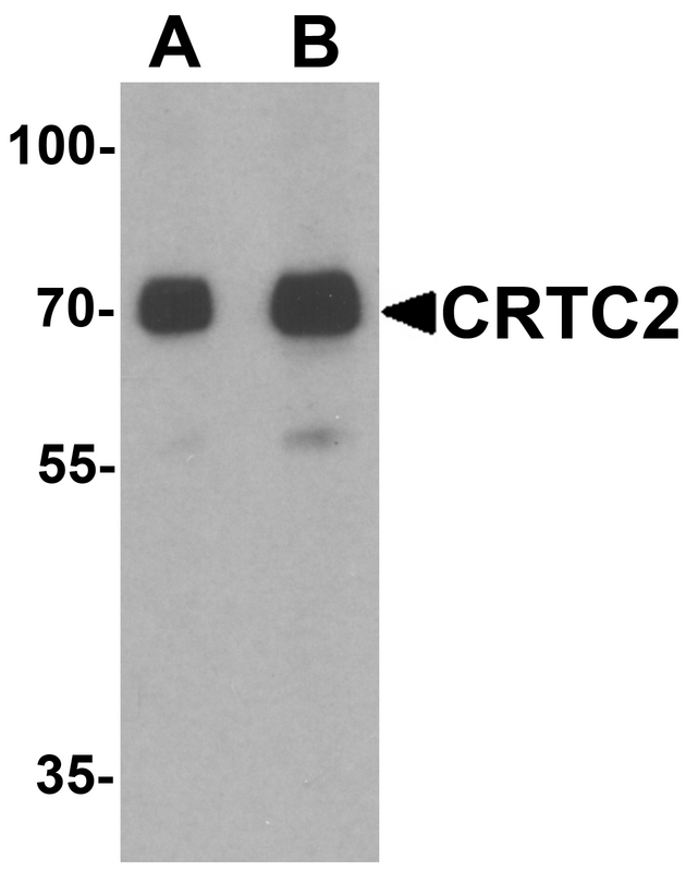 Western blot analysis of CRTC2 in human small intestine tissue lysate with CRTC2 antibody at (A) 0.5 and (B) 1 ug/ml.
