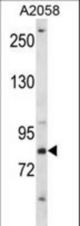 CRTC2 Antibody western blot of A2058 cell line lysates (35 ug/lane). The CRTC2 antibody detected the CRTC2 protein (arrow).