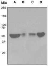 Western blot analysis on (A) fetal brain, (B) fetal thymus, (C) skeletal muscle and (D) heart lysates using anti-ACHR-beta antibody (LS-C105535).