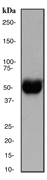 Western blot analysis on human brain lysate using anti-ACHR-beta antibody, dilution 1:1000.