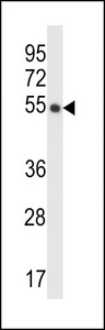 CRTRT1 Antibody western blot of human placenta tissue lysates (35 ug/lane). The CRTRT1 antibody detected the CRTRT1 protein (arrow).