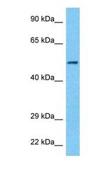Western blot of ACHB Antibody with human 721_B Whole Cell lysate.