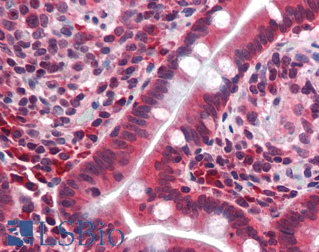 Anti-TFCP2L1 / CRTR1 antibody IHC of human small intestine. Immunohistochemistry of formalin-fixed, paraffin-embedded tissue after heat-induced antigen retrieval. Antibody LS-B3485 concentration 5 ug/ml.