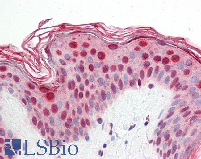 Anti-CRTR1 / TFCP2L1 antibody IHC staining of human skin. Immunohistochemistry of formalin-fixed, paraffin-embedded tissue after heat-induced antigen retrieval.