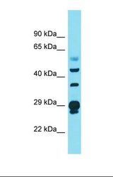 Western blot of Human Ovary Tumor. CRYL1 antibody dilution 1.0 ug/ml.