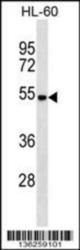 CRY2 Antibody (N-term) Western blot analysis in HL-60 cell line lysates (35 ug/lane). This demonstrates the CRY2 antibody detected the CRY2 protein (arrow).