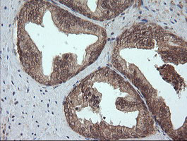 IHC of paraffin-embedded Human prostate tissue using anti-CRYAA mouse monoclonal antibody. (Heat-induced epitope retrieval by 10mM citric buffer, pH6.0, 100C for 10min).