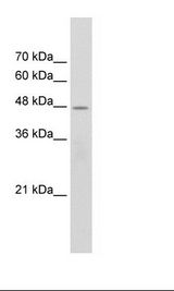 Jurkat Cell Lysate