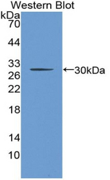 Western blot of recombinant CHRNB2.