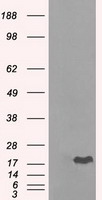 HEK293T cells were transfected with the pCMV6-ENTRY control (Left lane) or pCMV6-ENTRY CRYAB (Right lane) cDNA for 48 hrs and lysed. Equivalent amounts of cell lysates (5 ug per lane) were separated by SDS-PAGE and immunoblotted with anti-CRYAB.