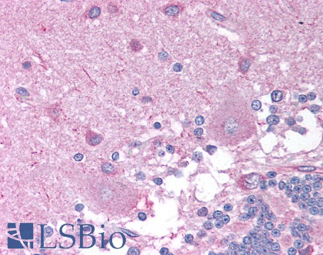 Anti-CHRNB2 antibody IHC of human brain, cerebellum. Immunohistochemistry of formalin-fixed, paraffin-embedded tissue after heat-induced antigen retrieval. Antibody LS-B937 concentration 10 ug/ml.