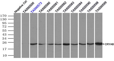 Immunoprecipitation(IP) of CRYAB by using monoclonal anti-CRYAB antibodies (Negative control: IP without adding anti-CRYAB antibody.). For each experiment, 500ul of DDK tagged CRYAB overexpression lysates (at 1:5 dilution with HEK293T lysate), 2 ug of anti-CRYAB antibody and 20ul (0.1 mg) of goat anti-mouse conjugated magnetic beads were mixed and incubated overnight. After extensive wash to remove any non-specific binding, the immuno-precipitated products were analyzed with rabbit anti-DDK polyclonal antibody.