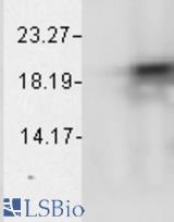 Western blot analysis of AlphaB Crystallin in bovine cell lines using a 1:1000 dilution of CRYAB / Alpha B Crystallin antibody.