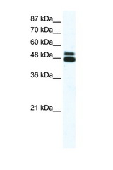 CHRNB2 antibody LS-B937 Western blot of Daudi Cell lysate. Antibody concentration 1 ug/ml.