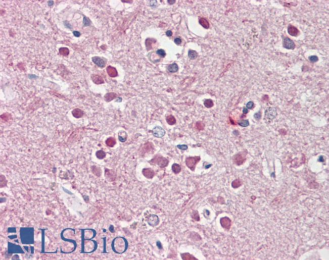 Anti-CHRNB2 antibody IHC of human brain, cortex. Immunohistochemistry of formalin-fixed, paraffin-embedded tissue after heat-induced antigen retrieval. Antibody LS-B8300 dilution 3.75 ug/ml.