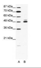 A: Marker, B: HepG2 Cell Lysate