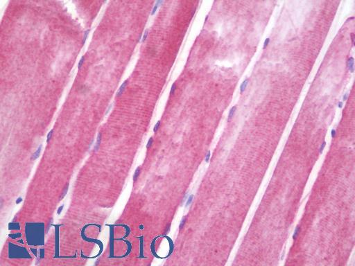 Anti-CRYAB / Alpha B Crystallin antibody IHC staining of human skeletal muscle. Immunohistochemistry of formalin-fixed, paraffin-embedded tissue after heat-induced antigen retrieval. Antibody LS-B9628 dilution 1:100.