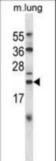 CRYAB Antibody western blot of mouse lung tissue lysates (35 ug/lane). The CRYAB antibody detected the CRYAB protein (arrow).
