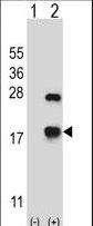 Western blot of CRYAB (arrow) using rabbit polyclonal CRYAB Antibody. 293 cell lysates (2 ug/lane) either nontransfected (Lane 1) or transiently transfected (Lane 2) with the CRYAB gene.