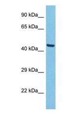 Western blot of ACHB3 Antibody with human A549 Whole Cell lysate.
