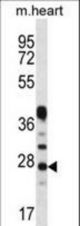 CRYBA1 Antibody western blot of mouse heart tissue lysates (35 ug/lane). The CRYBA1 antibody detected the CRYBA1 protein (arrow).