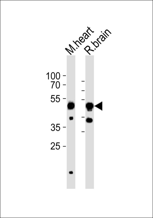 Western blot of lysates from mouse heart, rat brain tissue lysate (from left to right) with CHRNB3 Antibody. Antibody was diluted at 1:1000 at each lane. A goat anti-rabbit IgG H&L (HRP) at 1:10000 dilution was used as the secondary antibody. Lysates at 35 ug per lane.