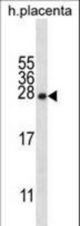 CRYBA1 Antibody western blot of human placenta tissue lysates (35 ug/lane). The CRYBA1 antibody detected the CRYBA1 protein (arrow).