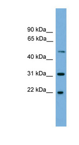 CRYBA4 antibody LS-C135260 Western blot of 293T cell lysate.