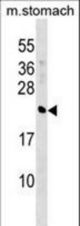 CRYBA4 Antibody western blot of mouse stomach tissue lysates (35 ug/lane). The CRYBA4 antibody detected the CRYBA4 protein (arrow).