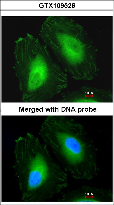 Immunofluorescence of paraformaldehyde-fixed HeLa using Beta-crystallin A4 antibody at 1:200 dilution.
