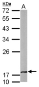 Sample (50 ug of whole cell lysate). A: mouse brain. 12% SDS PAGE. CRYBA4 antibody diluted at 1:1000.