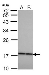 Sample (30 ug of whole cell lysate). A: H1299, B: HeLa. 12% SDS PAGE. CRYBA4 antibody diluted at 1:1000