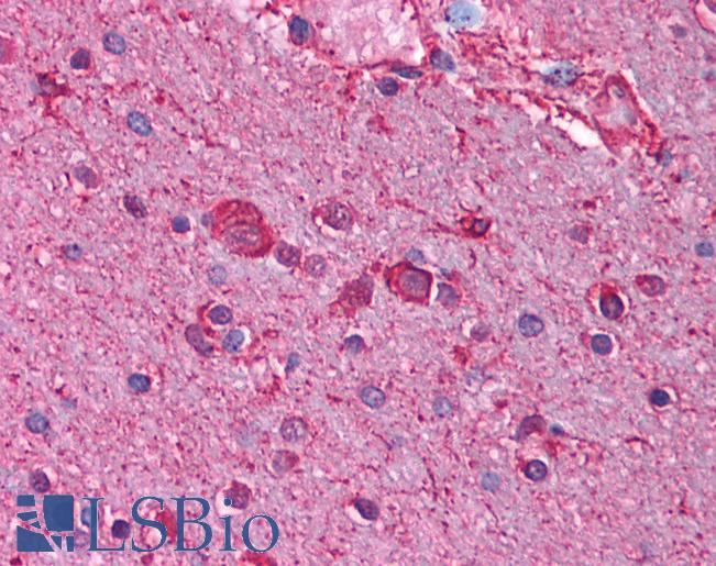 Anti-CHRNB3 antibody IHC of human brain, cortex. Immunohistochemistry of formalin-fixed, paraffin-embedded tissue after heat-induced antigen retrieval. Antibody LS-B938 concentration 5 ug/ml.