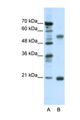 CHRNB3 antibody LS-B938 Western blot of Jurkat Cell lysate. Antibody concentration 1 ug/ml.