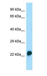 CRYGA antibody Western Blot of HCT15.
